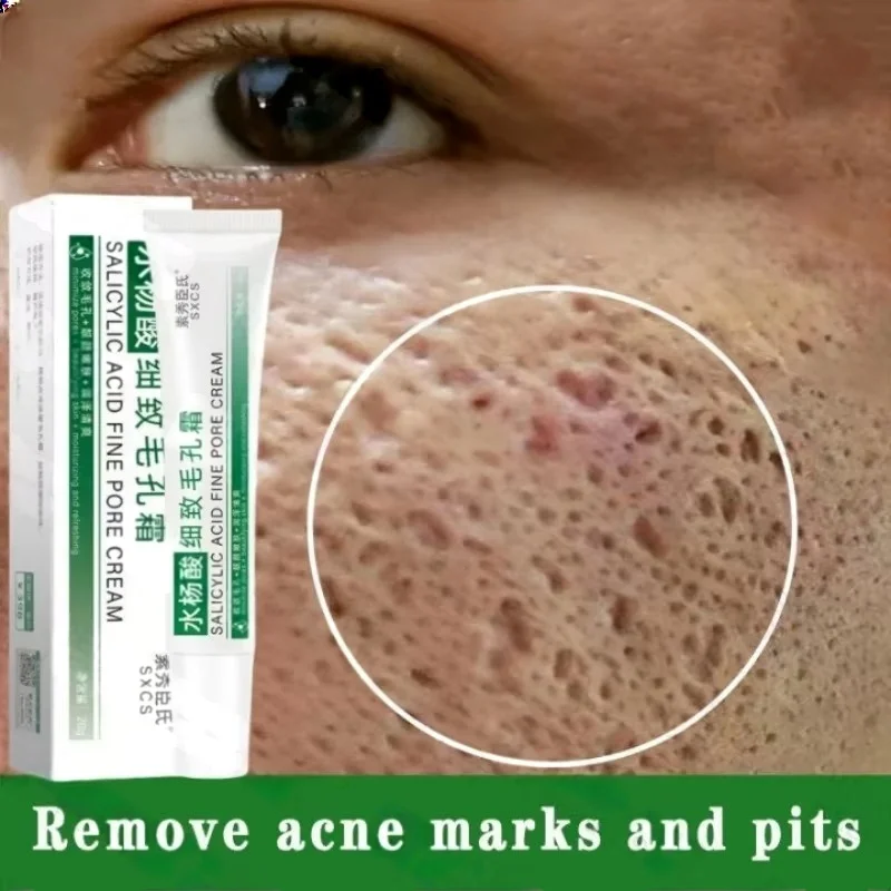 Salicylic Acid Blackhead Remover - 살리실산 모공 클리어링 크림 모공 축소