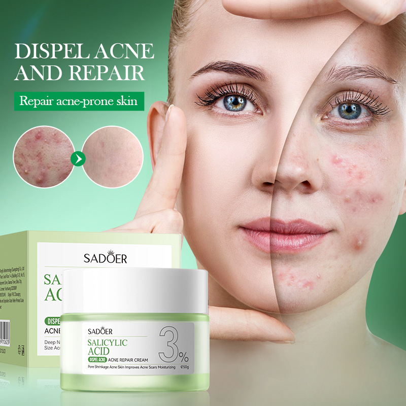Salicylic Acid Blackhead Remover - 살리실산 여드름 치료 크림, 여드름 자국