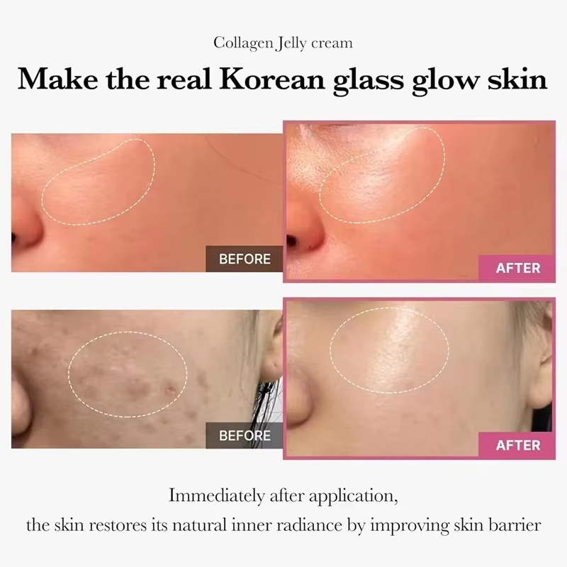 100g 젤리 페이스 크림 콜라겐 소프트 스파 영양 모 - Niacinamide Pore Shrinking Essence 리뷰 및 가격