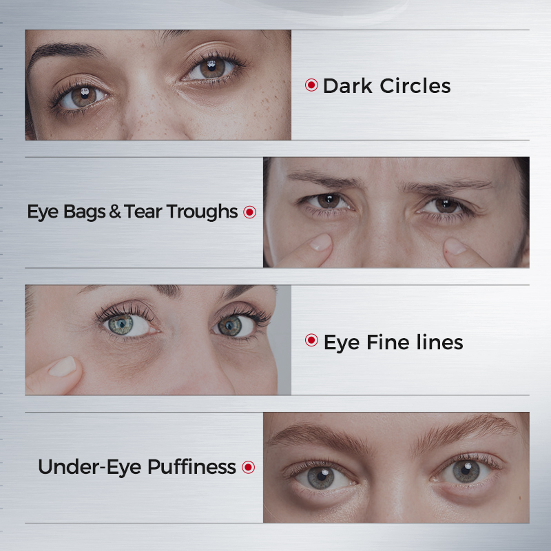 다크서클용 아이패치 – 콜라겐, 아세틸 헥사펩타이드-8 - Collagen Under Eye Patches 리뷰 및 가격