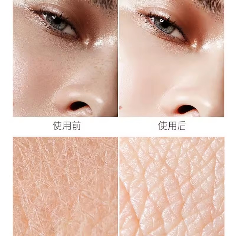 히알루론산 나이아신 아미드 에센스, 페이스 케어, 모공 - Niacinamide Pore Shrinking Essence 리뷰 및 가격