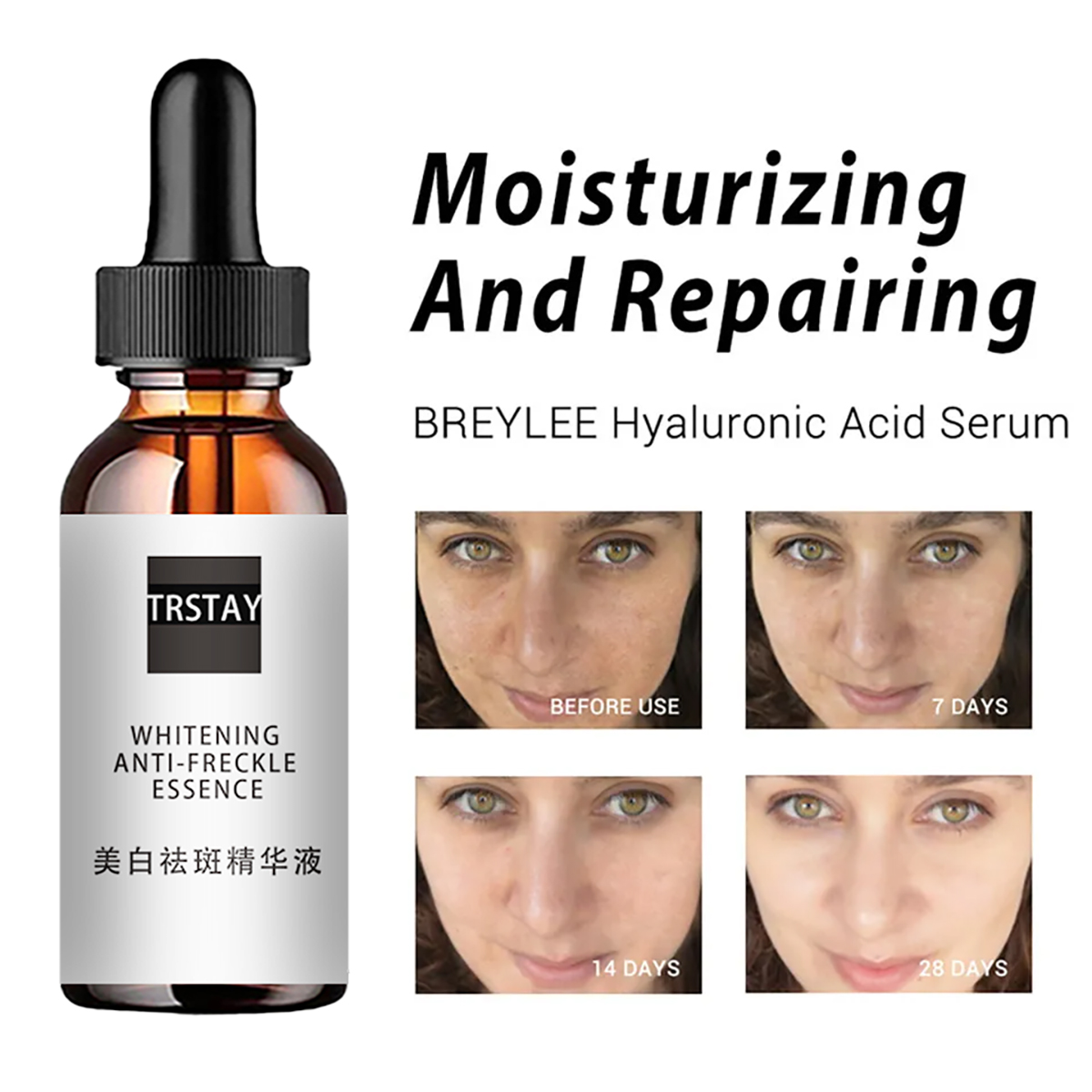 나이아신 아미드 산 페이셜 에센스 딥 모이스춰 라이징, - Niacinamide Pore Shrinking Essence 리뷰 및 가격
