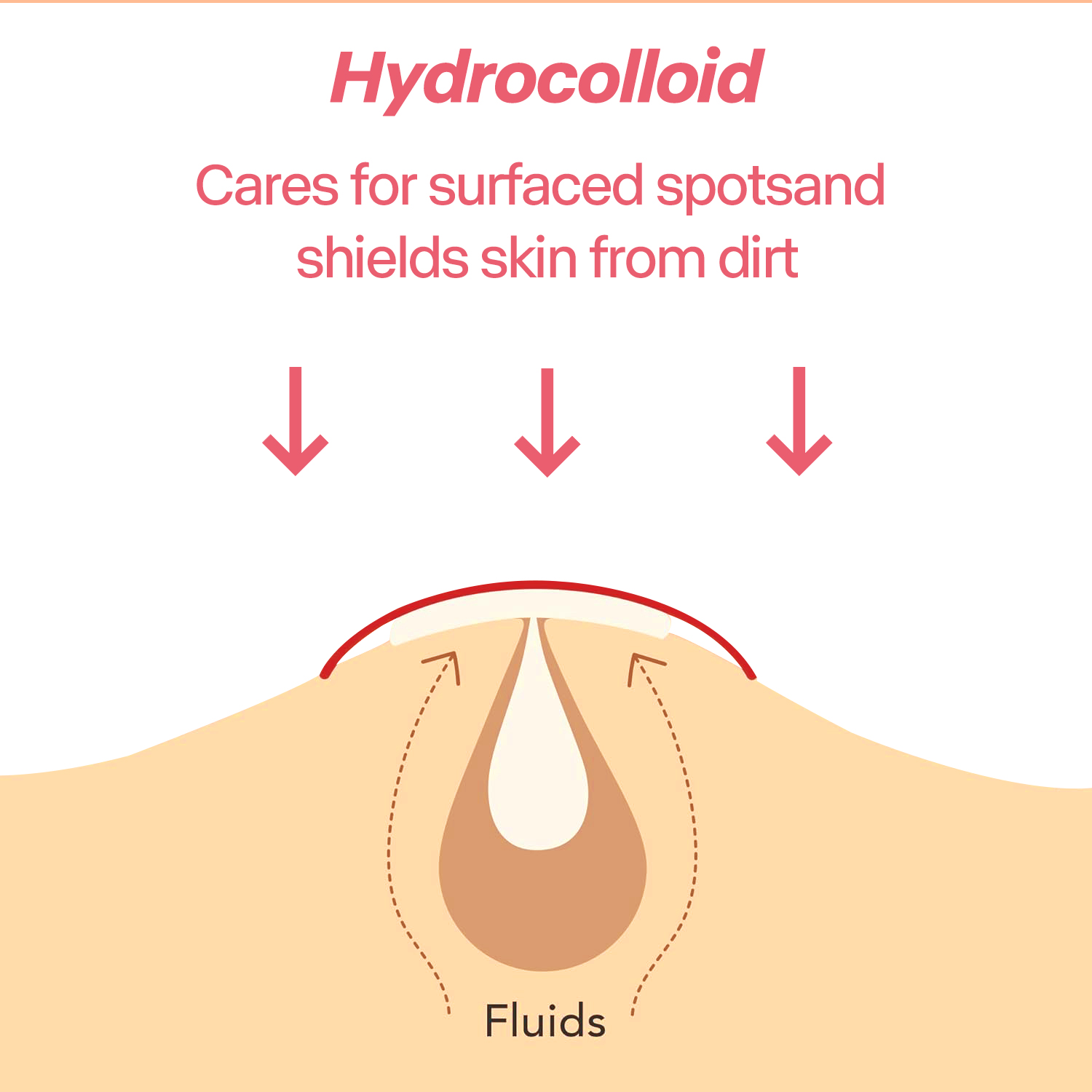 216개 살리실산 여드름 패치 빠른 여드름 및 블랙헤드 - Salicylic Acid Blackhead Remover 리뷰 및 가격