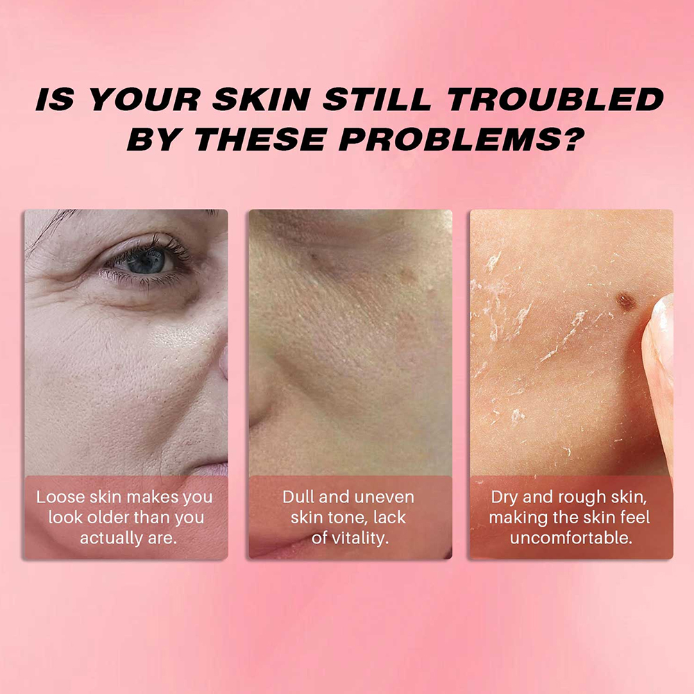 얼굴 수축 모공 리페어 콜라겐 젤리 크림, 피부 장벽  - Niacinamide Pore Shrinking Essence 리뷰 및 가격